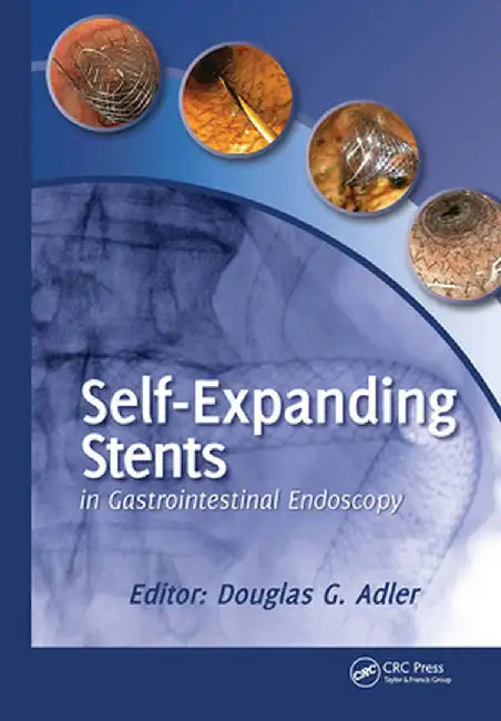 Self-Expanding Stents in Gastrointestinal Endoscopy by Douglas Adler