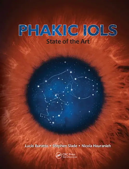 Phakic IOLs: State of the Art by Lucio Buratto