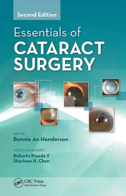 Essentials of Cataract Surgery by Bonnie Henderson