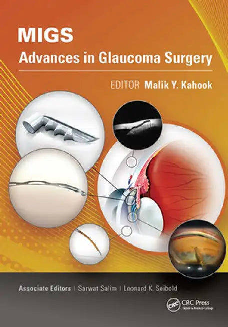 Migs: Advances in Glaucoma Surgery by Malik Kahook