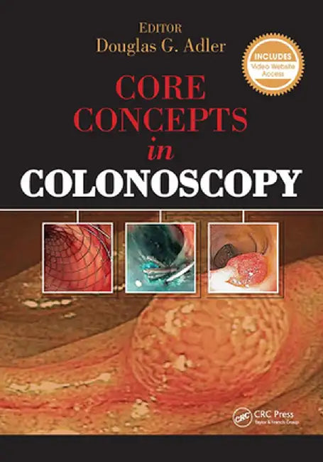 Core Concepts in Colonoscopy by Douglas Adler