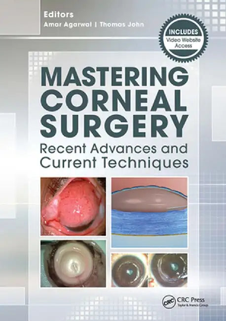 Mastering Corneal Surgery: Recent Advances and Current Techniques by Amar Agarwal