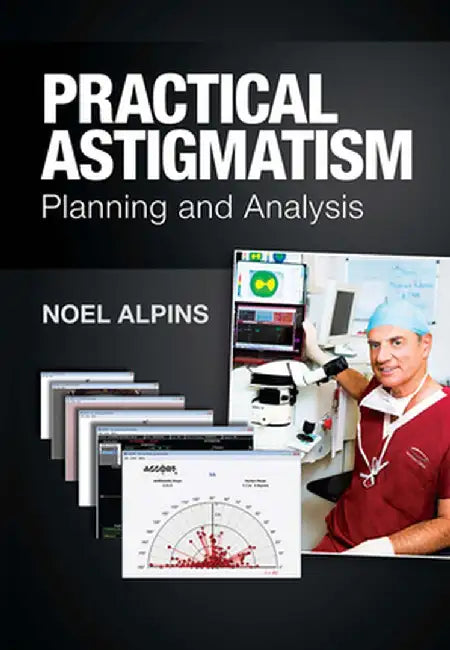 Practical Astigmatism: Planning and Analysis by Noel Alpins