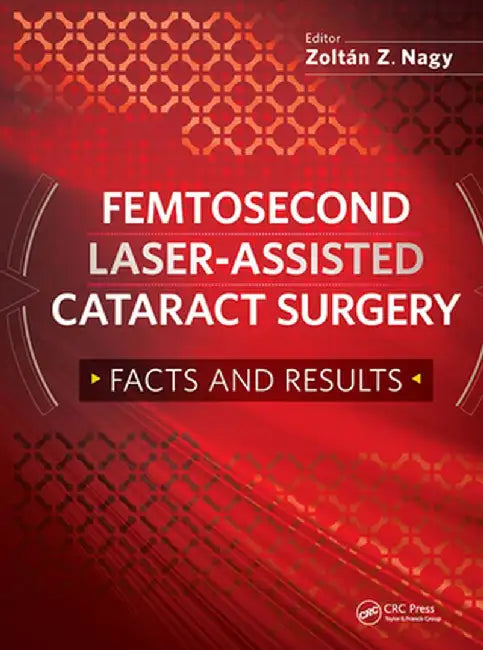 Femtosecond Laser-Assisted Cataract Surgery: Facts and Results by Zoltan Nagy