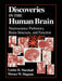 Discoveries in the Human Brain: Neuroscience Prehistory, Brain Structure, and Function by Louise H. Marshall