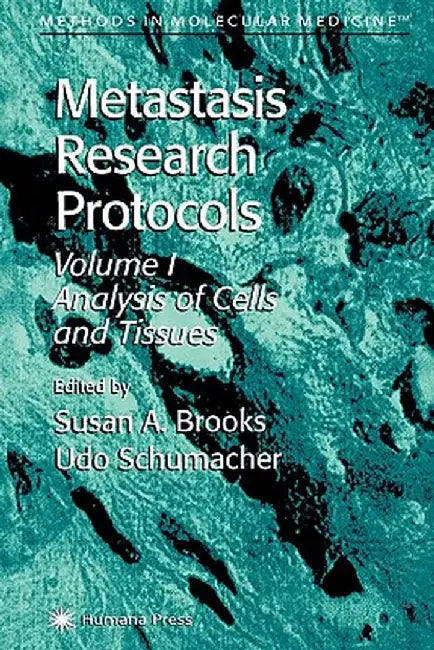 Metastasis Research Protocols by Susan A. Brooks