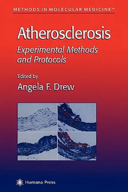 Atherosclerosis: Experimental Methods and Protocols by Angela F. Drew