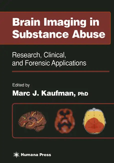 Brain Imaging in Substance Abuse: Research, Clinical, and Forensic Applications by Marc J. Kaufman