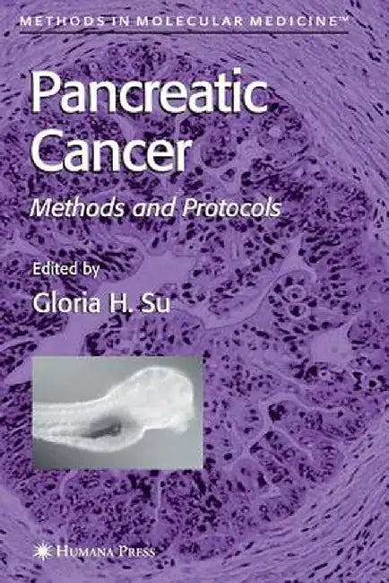 Pancreatic Cancer: Methods and Protocols by Gloria H. Su