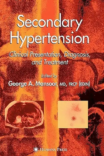 Secondary Hypertension: Clinical Presentation, Diagnosis, and Treatment by George A. Mansoor
