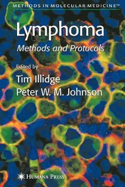 Lymphoma by Tim Illidge