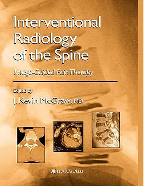 Interventional Radiology of the Spine: Image-Guided Pain Therapy by J. Kevin McGraw