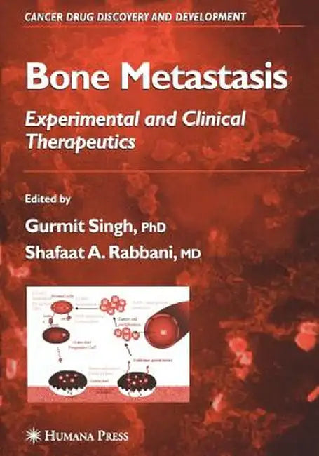 Bone Metastasis by Gurmit Singh