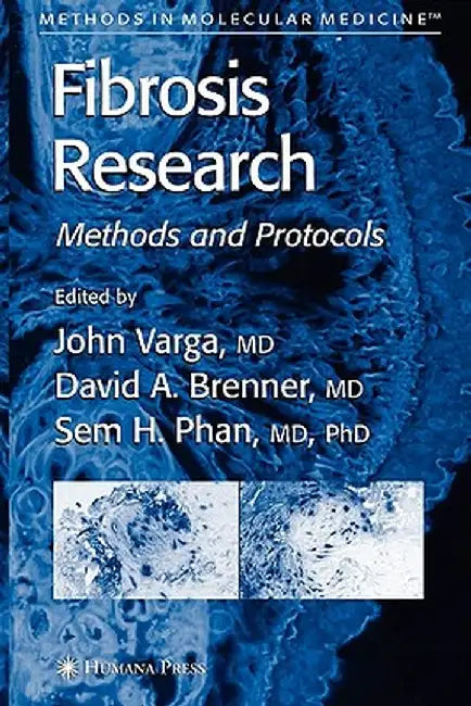Fibrosis Research: Methods and Protocols by John Varga