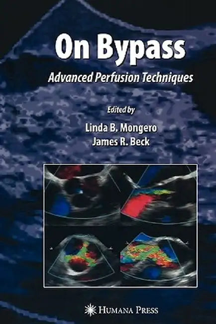 On Bypass: Advanced Perfusion Techniques by Linda B. Mongero