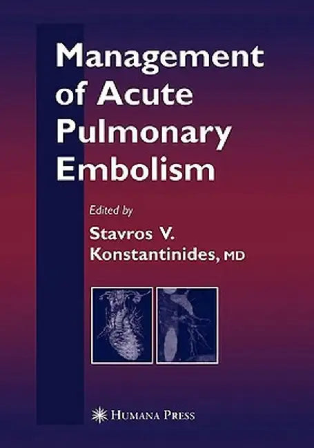 Management of Acute Pulmonary Embolism by Stavros V. Konstantinides