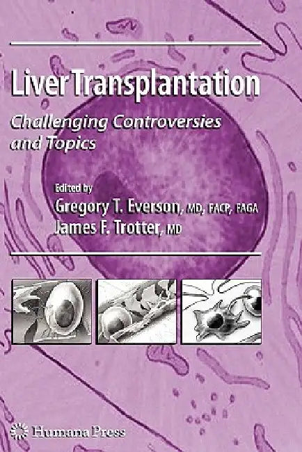 Liver Transplantation: Challenging Controversies and Topics by Gregory T. Everson