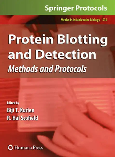 Protein Blotting and Detection: Methods and Protocols by Biji T. Kurien