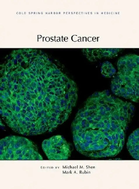 Prostate Cancer by Michael Shen
