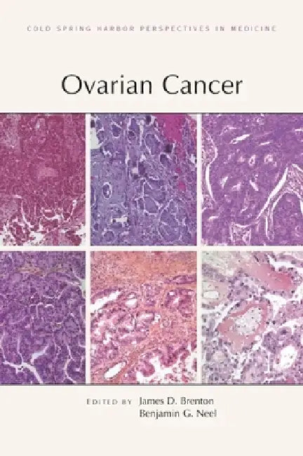 Ovarian Cancer by James D. Brenton, Benjamin G. Neel, Kathleen R. Cho