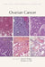Ovarian Cancer by James D. Brenton, Benjamin G. Neel, Kathleen R. Cho