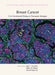 Breast Cancer: From Fundamental Biology to Therapeutic Strategies by Jane E. Visvader, Jeffrey M. Rosen