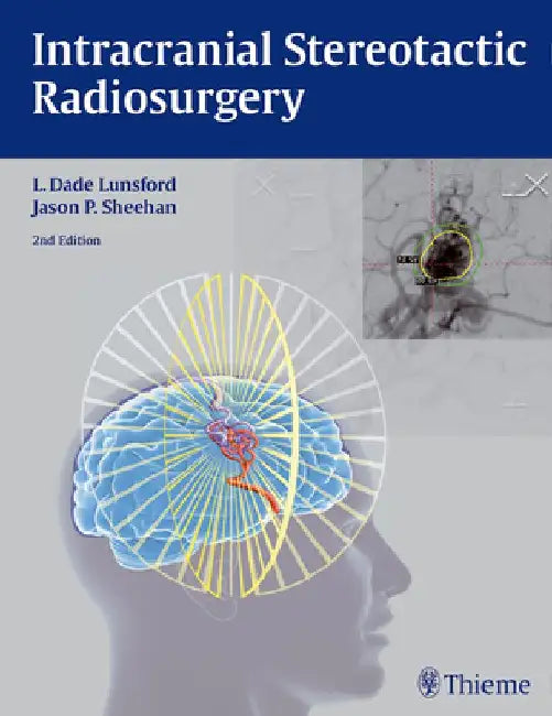 Intracranial Stereotactic Radiosurgery by L. Dade Lunsford