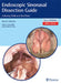 Endoscopic Sinonasal Dissection Guide: Including Orbit and Skull Base by Roy R. Casiano, Islam Herzallah, Jean Eloy