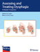 Assessing and Treating Dysphagia: A Lifespan Perspective by Debra Suiter