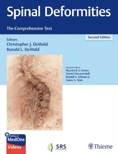 Spinal Deformities: The Comprehensive Text by Christopher Dewald, Ronald Dewald