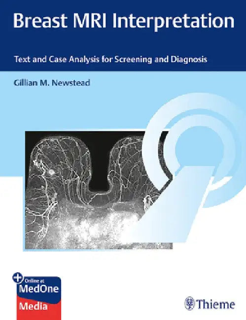 Breast MRI Interpretation: Text and Online Case Analysis for Screening and Diagnosis by Gillian Newstead