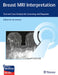 Breast MRI Interpretation: Text and Online Case Analysis for Screening and Diagnosis by Gillian Newstead