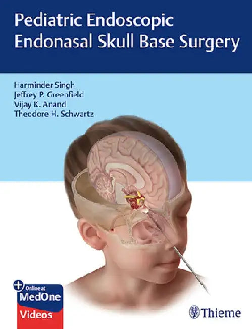 Pediatric Endoscopic Endonasal Skull Base Surgery by Harminder Singh