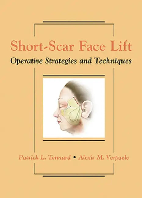 Short-Scar Face Lift: Operative Strategies and Techniques by Patrick Tonnard