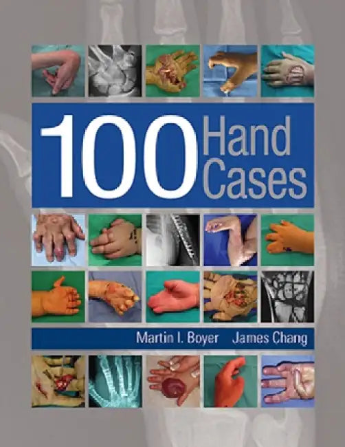100 Hand Cases by Martin Boyer