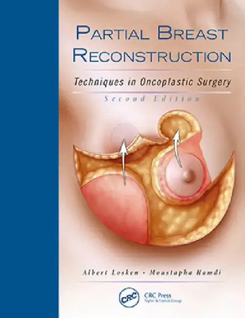 Partial Breast Reconstruction: Techniques in Oncoplastic Surgery by Albert Losken
