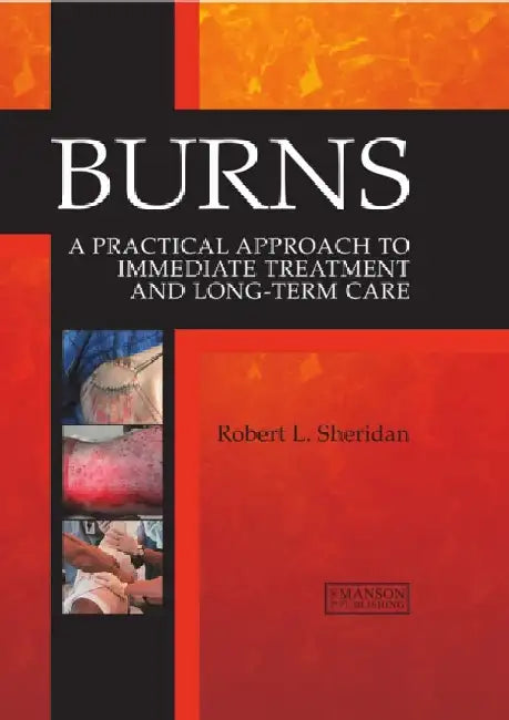 Burns: A Practical Approach to Immediate Treatment and Long Term Care by Robert Sheridan