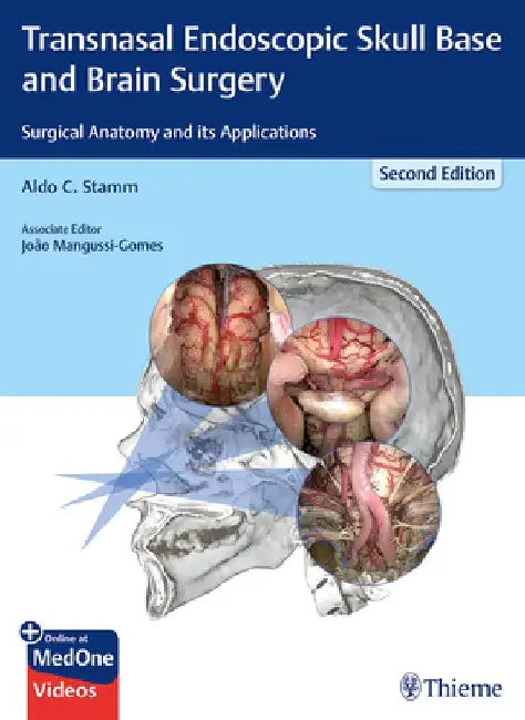 Transnasal Endoscopic Skull Base and Brain Surgery: Surgical Anatomy and Its Applications by Aldo C. Stamm