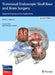 Transnasal Endoscopic Skull Base and Brain Surgery: Surgical Anatomy and Its Applications by Aldo C. Stamm