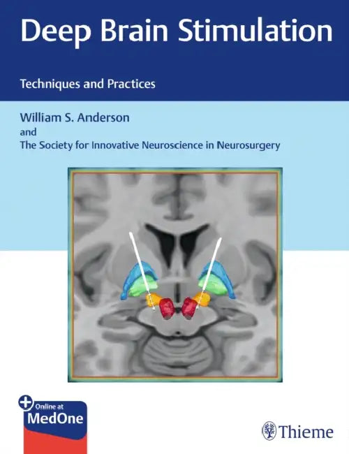 Deep Brain Stimulation: Techniques and Practices by William S. Anderson, The Society for Innovative Neuroscience