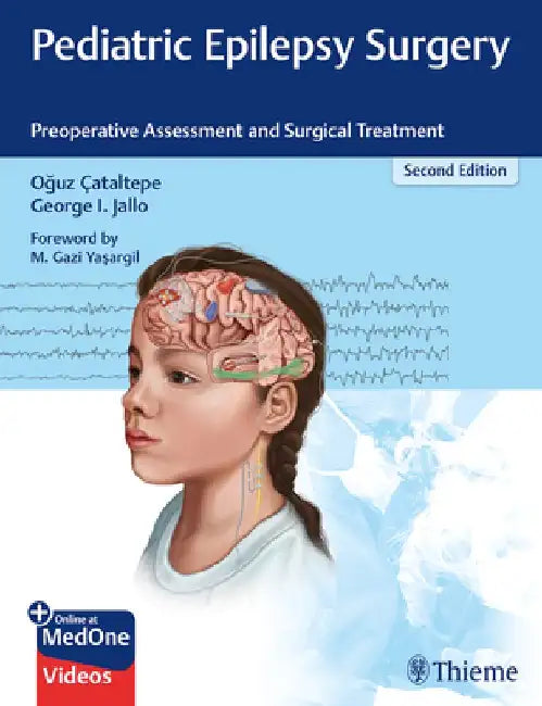 Pediatric Epilepsy Surgery: Preoperative Assessment and Surgical Treatment by Oguz Cataltepe