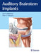 Auditory Brainstem Implants by Eric P. Wilkinson