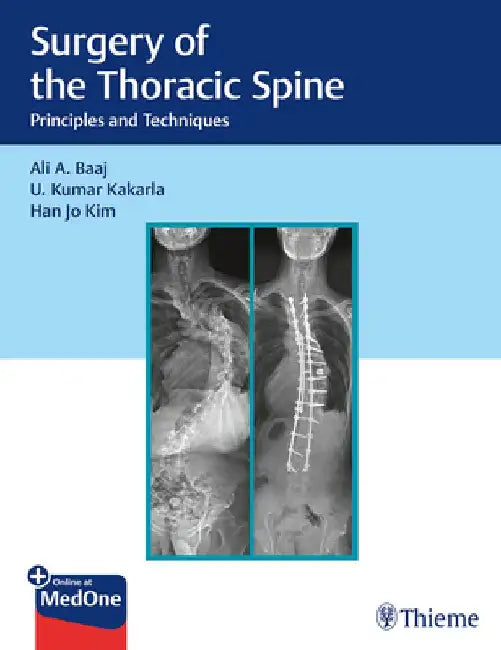 Surgery of the Thoracic Spine: Principles and Techniques by Ali A. Baaj