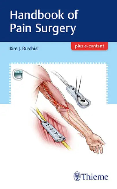 Handbook of Pain Surgery by Kim Burchiel