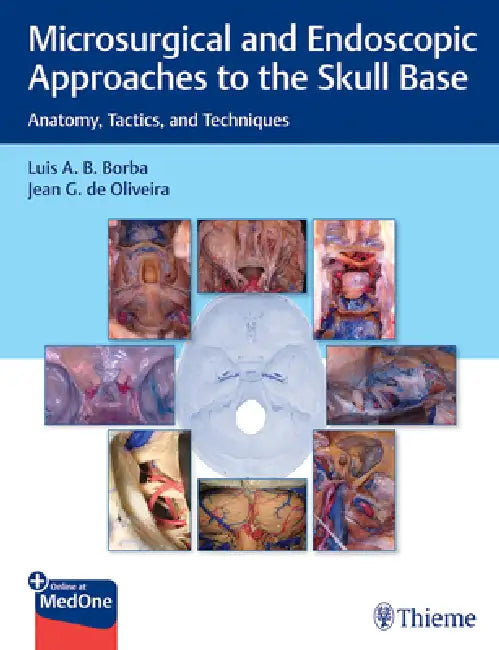 Microsurgical and Endoscopic Approaches to the Skull Base: Anatomy, Tactics, and Techniques by Luis Borba, Jean de Oliveira