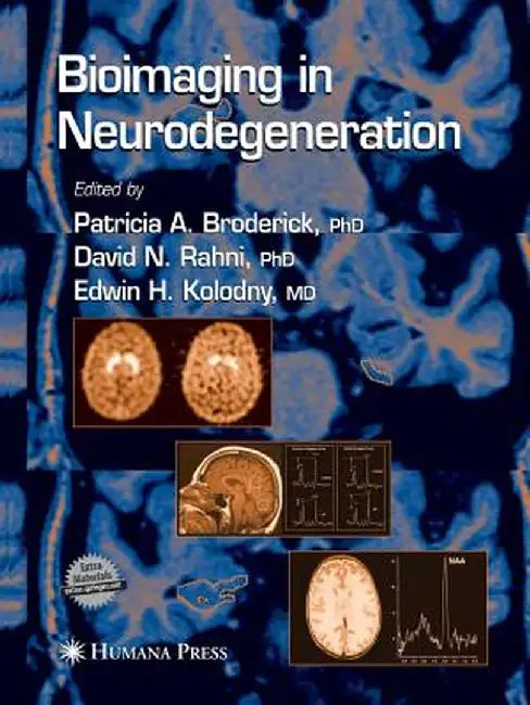 Bioimaging in Neurodegeneration by Patricia A. Broderick