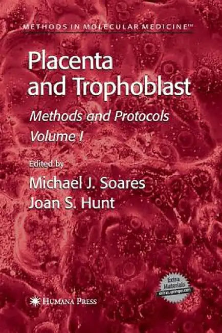 Placenta and Trophoblast: Methods and Protocols, Volume I by Michael J. Soares