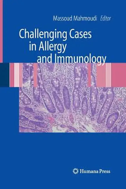 Challenging Cases in Allergy and Immunology by Massoud Mahmoudi
