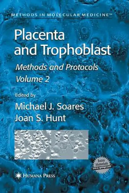 Placenta and Trophoblast: Methods and Protocols, Volume II by Michael J. Soares