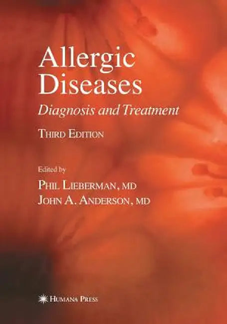 Allergic Diseases: Diagnosis and Treatment by Phil Lieberman